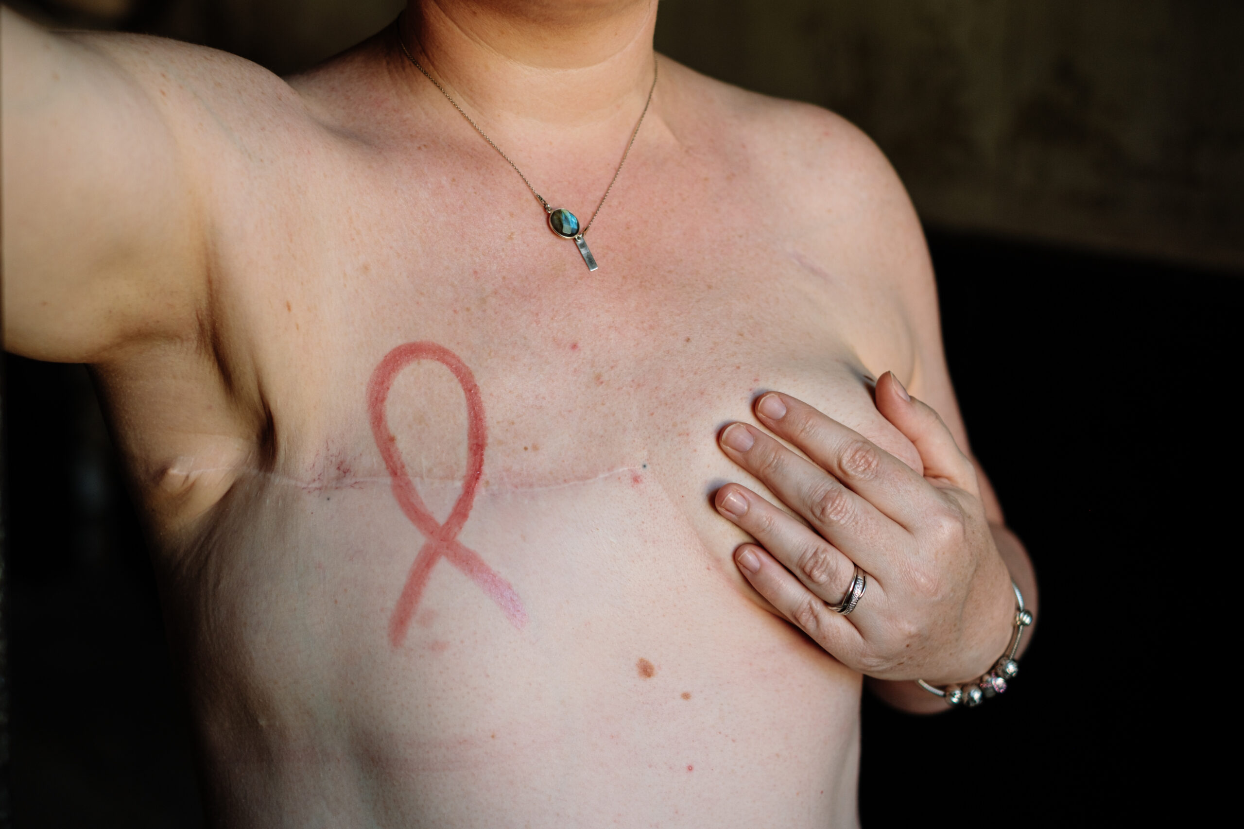 ruban rose - cancer du sein - audrey guyon - photographe manche